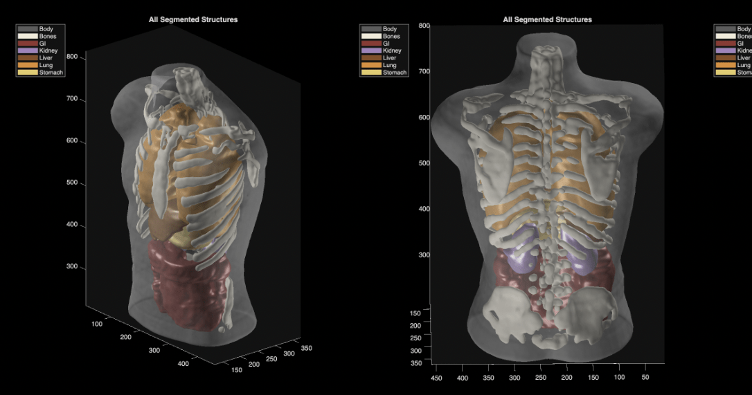 Midjourney shows its ultrasound scanner, but evidence is still scarce