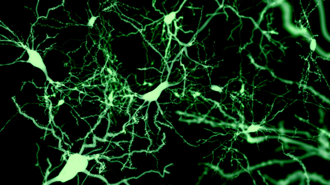 Sst-Chodl neurons trigger sleep-like activity in mice