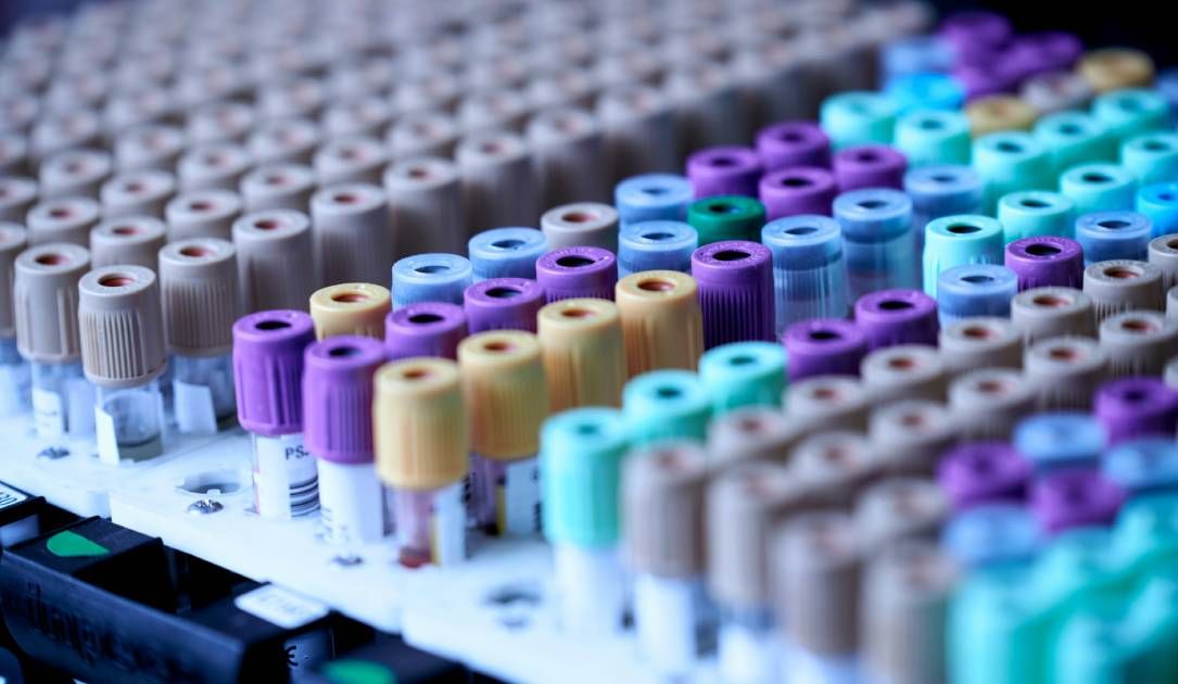 Labcorp agrees to $2.29 million settlement over AMCA data breach