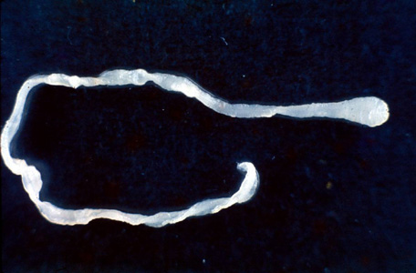 Surgeons repairing a hernia found a live 10-inch tapeworm