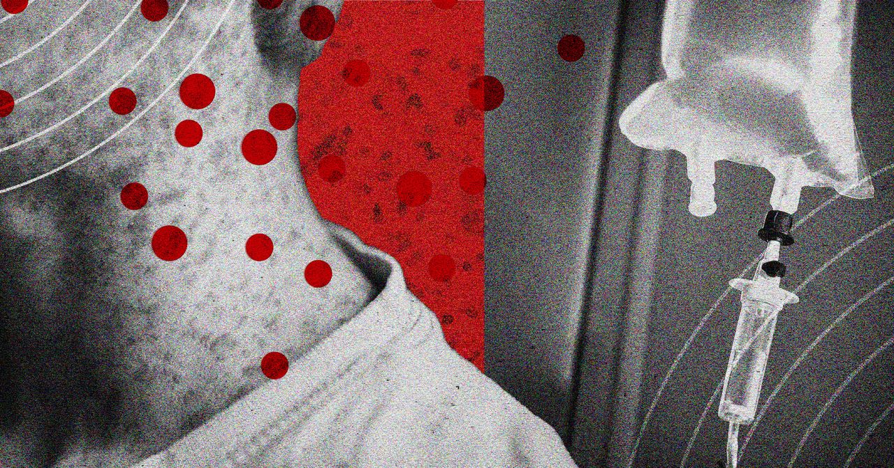 Measles treatments gain attention as US cases climb