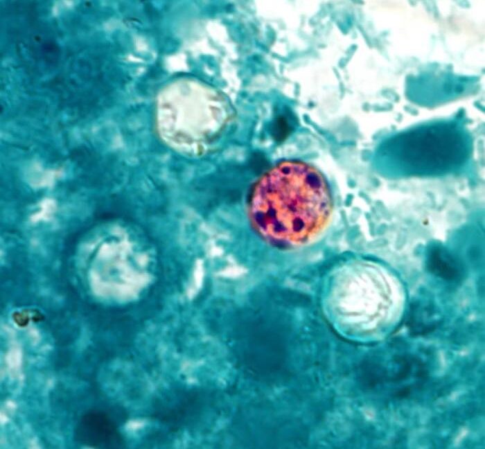 FDA cyclospora outbreak inquiry adds 72 cases to a fast-rising tally